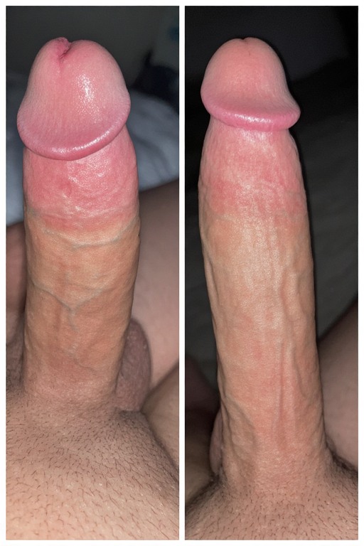 Resultado