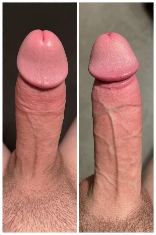 Resultado