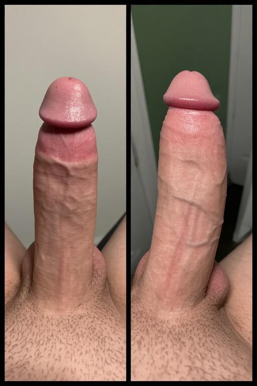 Resultado
